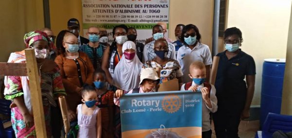 Rentrée scolaire : le geste salutaire du Rotary Club Lomé-Perle à l'orphelinat "Marie Reine de la Paix" et aux enfants atteints d'albinisme Don Rotary Club Lome perle 2 600x284 - Rentrée scolaire : le geste salutaire du Rotary Club Lomé-Perle à l'orphelinat "Marie Reine de la Paix" et aux enfants atteints d'albinisme